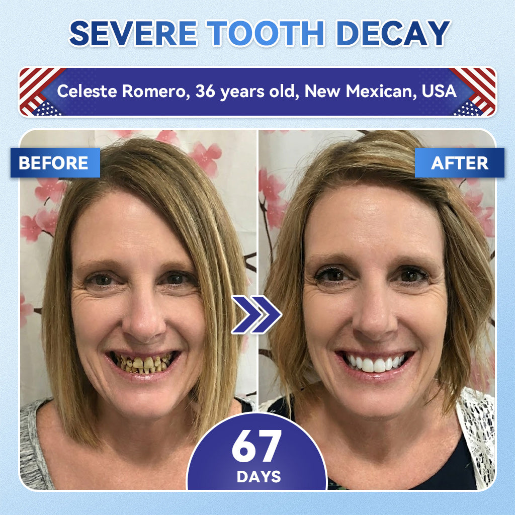 LUMIVO® 🦷 Tideglusib Fast‑Dissolving Tooth & Gum Repair Oral Strips ✨