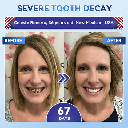 LUMIVO® 🦷 Tideglusib Fast‑Dissolving Tooth & Gum Repair Oral Strips ✨