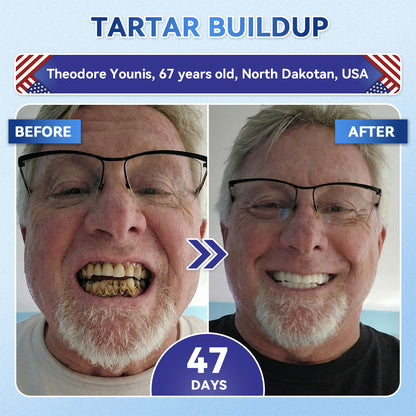 LUMIVO® 🦷 Tideglusib Fast‑Dissolving Tooth & Gum Repair Oral Strips ✨