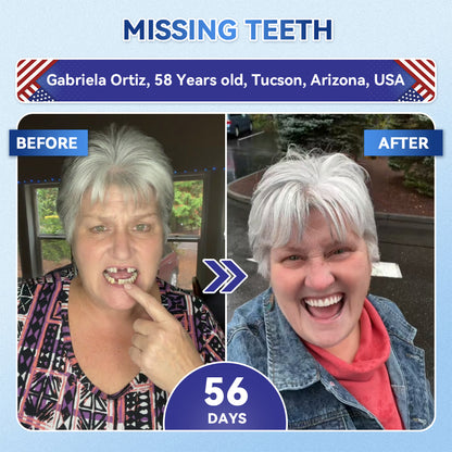 LUMIVO® 🦷 Tideglusib Fast‑Dissolving Tooth & Gum Repair Oral Strips ✨