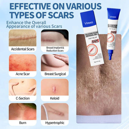 Silicone Scar Gel for Old and New Scars, Scar Treatment for Acne Surgical Burn and Stretch Marks, Medical Grade Silicone Scar Gel, Fast Absorbing