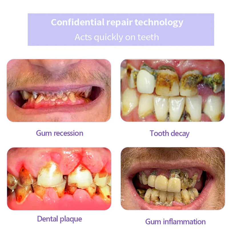 Pryxo™ Teeth Restoration Mineral Powder
