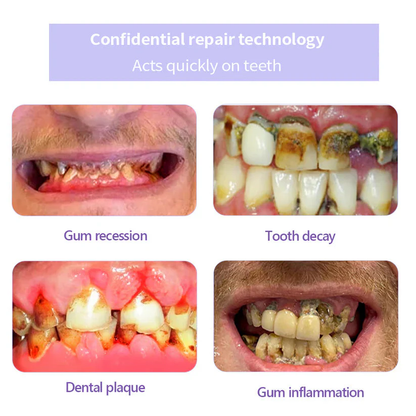 Pryxo™ Teeth Restoration Mineral Powder