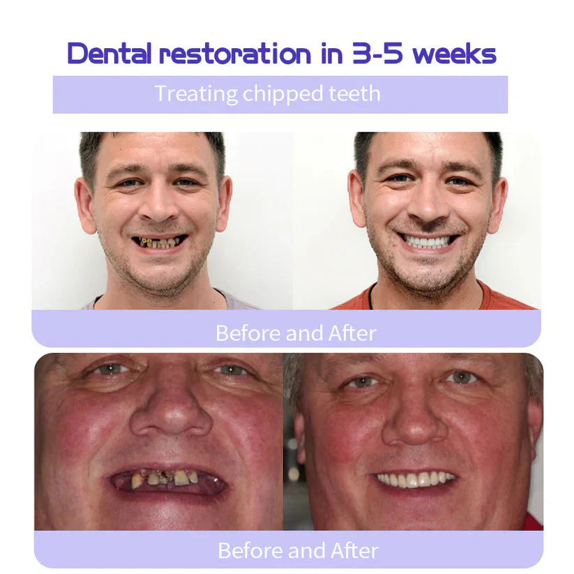 Pryxo™ Teeth Restoration Mineral Powder