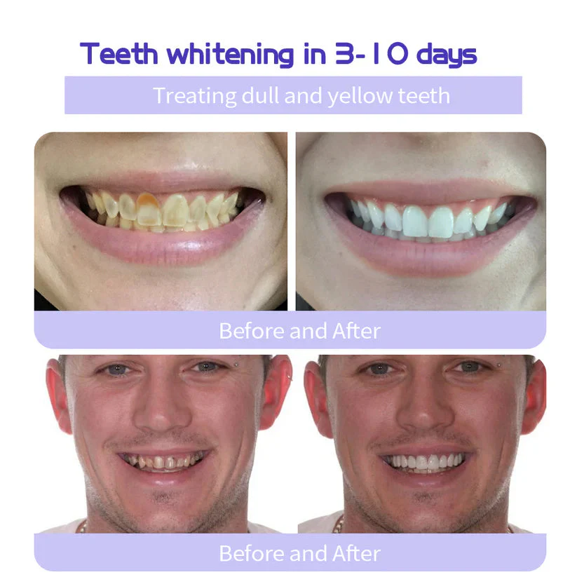 Pryxo™ Teeth Restoration Mineral Powder