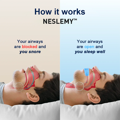 Pryхo™ Professional intelligent anti-snoring device