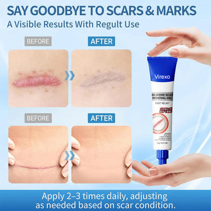 Silicone Scar Gel for Old and New Scars, Scar Treatment for Acne Surgical Burn and Stretch Marks, Medical Grade Silicone Scar Gel, Fast Absorbing