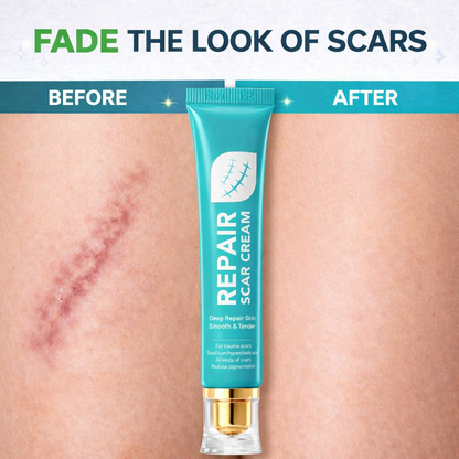 🌿 Scar Repair Cream|Treats Old and New Scars, Burns and More