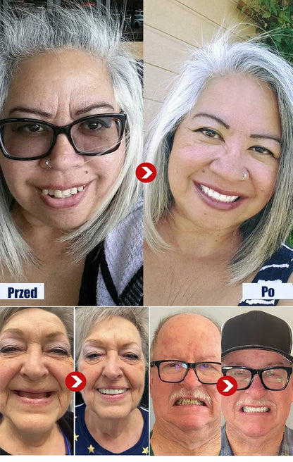 Pełnofunkcyjne protezy zębowe 'Pewny Uśmiech'