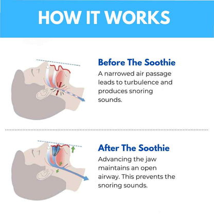Pryхo™ Professional intelligent anti-snoring device