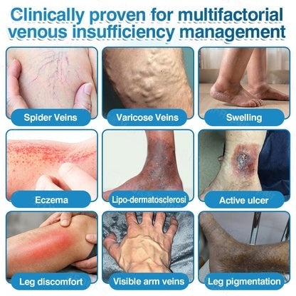 🇦🇺👨‍⚕️✅LUMIVO™ VeinRepair Microneedle Patch Roll⚡Instant Relief, Long-Term Results