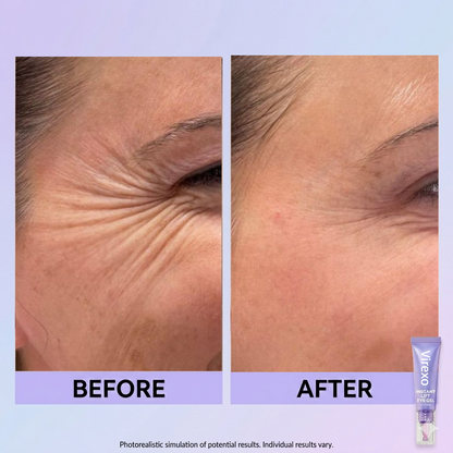 Final 3 Hours: 60%OFF🔥 Instant Lift Eye Gel for Puffiness, Bags & Dark Circles