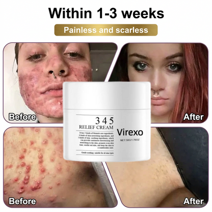 Made and Shipped from USA ✨Virexo™Skin Repair Cream 🍀