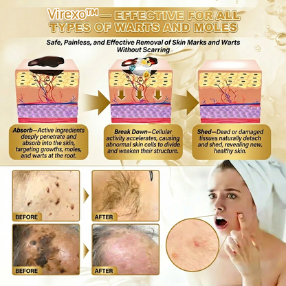 Made and Shipped from USA ✨Virexo™Skin Repair Cream 🍀