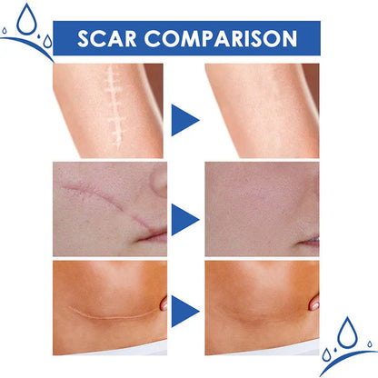 🔥Limited-time 60% sale--LUMIVO Scar Repair Cream — Smooth, Clear, Confident Skin