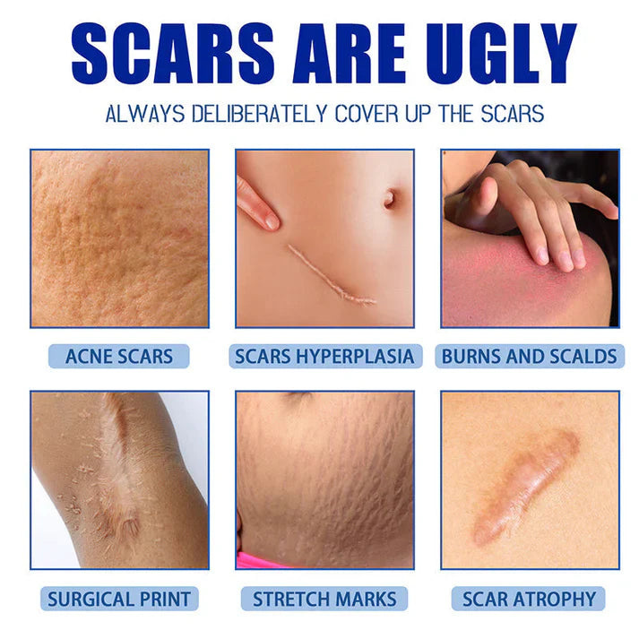 🔥Limited-time 60% sale--LUMIVO Scar Repair Cream — Smooth, Clear, Confident Skin